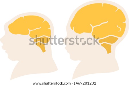 Silhouette image of the head and skull of a newborn child with a normal cranium and with microcephaly and severe microcephaly. Virus of Zika. Vector. Flat design