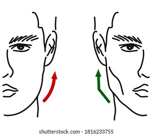 Silhouette of a male face on a white background. Correction of the shape of the face and chin. Vector illustration.