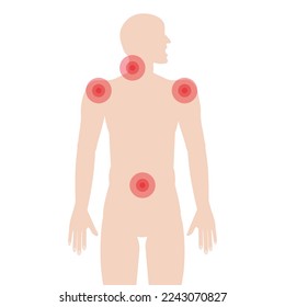 A silhouette of a man with a schematic image of pain in the shoulder joints, neck and lower back. Vector illustration