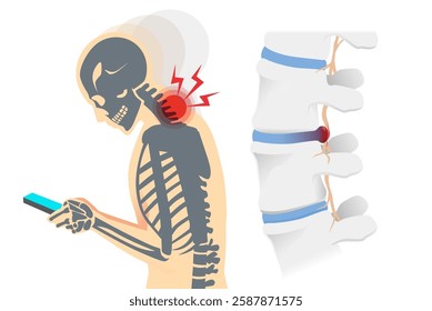 Silhouette man with Skeleton use smartphone with bending neck down more angle made neck pain from cervical disk herniation.