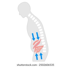 Silhouette of a person whose internal organs are compressed due to poor posture caused by a stooped back