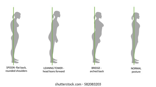 Silhouette Of Women With Correct And Incorrect Posture. Vector Illustration.