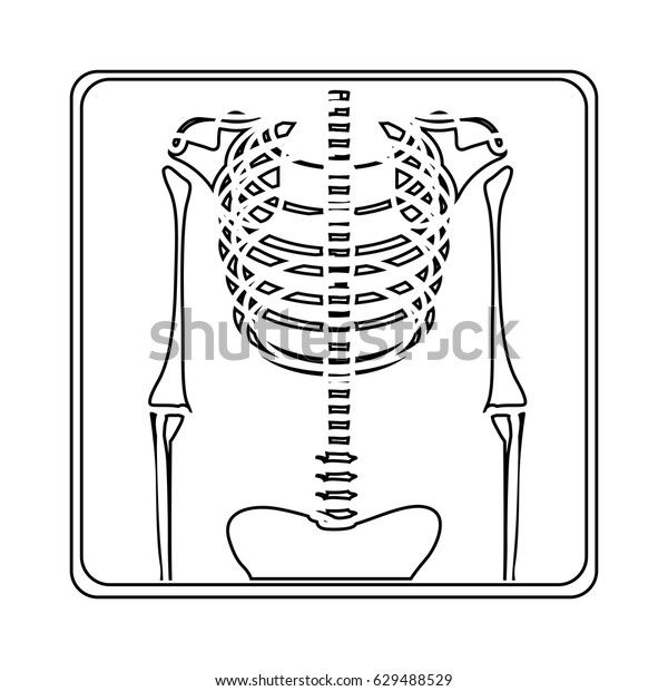 Silhouette Xray Bones Vector Illustration Stock Vector (Royalty Free ...