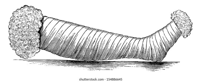 Silicate Leg Wrap, vintage engraved illustration. Usual Medicine Dictionary by Dr Labarthe - 1885