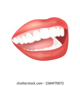 Silicone Trainer For Teeth. Invisible Braces On The Teeth. Beautiful Woman Smile With Braces. Open Mouth With Teeth Isolated On A White Background. Vector Stock Illustration For Dental Clinic. 
