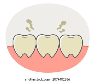 Simple and cute illustration of teeth and gums suffering from yellowing