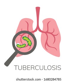 Simple, flat illustration of a lung disease. Pneumonia infographics, drawing for informational, medical poster 