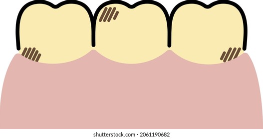 simple illustration of yellowed teeth