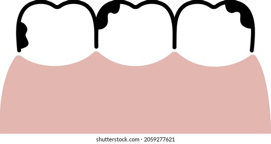 ilustración de línea simple de dientes malos