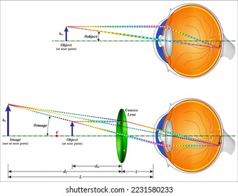 The simple magnifier is a convex lens used to produce an enlarged image of an object on the retina,