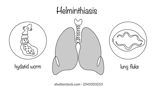 Una simple ilustración médica que representa los tipos de helmintos que causan enfermedades en el sistema respiratorio humano. Pulmones humanos y helmintos. Ilustración vectorial.