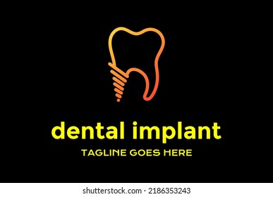 Simple Minimalist Modern Dental Implant Line Outline Logo Design Vector
