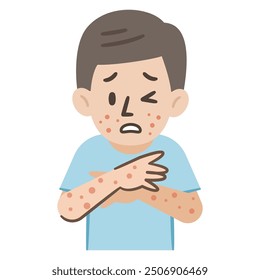 Simple vector illustration of a man infected with mpox