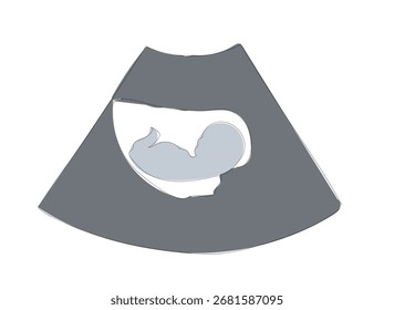 Dibujo de línea continua única de contorno dibujado a mano por ultrasonido fetal.  Sonograma del embarazo de un feto en la ilustración del boceto del Vector del útero para imprimir. Vector hecho a mano, no Al. 
