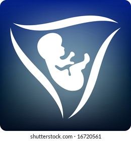 singleton pregnancy