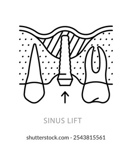 Levantamiento de senos paranasales, icono. Levantamiento de senos paranasales con implante dental. Ilustración lineal del procedimiento para proporcionar suficiente hueso y diente de reemplazo. Odontología y restauración dental. Icono de trazo editable