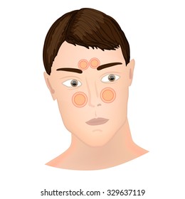 1,359 Sinus infection Stock Vectors, Images & Vector Art | Shutterstock