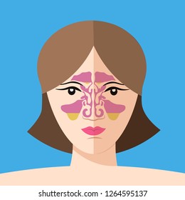 sinusitis disease, vector nose illustration, sinus anatomy, human respiratory system. Flat style