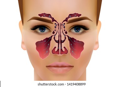 Sinusitis. Healthy and inflammation nasal sinus vector illustration