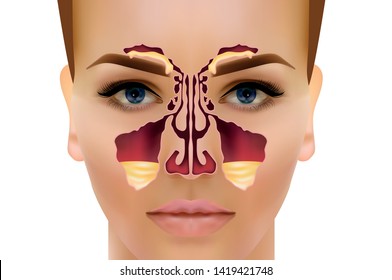 Sinusitis. Healthy and inflammation nasal sinus vector illustration