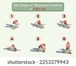 Six stages of recovery position and 6 steps of recovery position in first aid of an unconscious person after an accident illustration. The stages of recovery position in any dangerous accident at work
