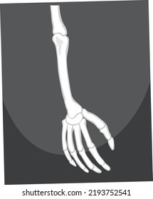 Skeleton of arm and hand illustration