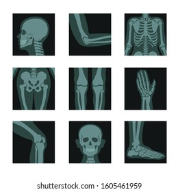 Skeleton and bones x-ray shots, head and hands, legs and joints