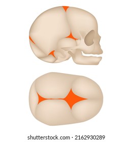 The skeleton of a child with the designation of not overgrown fontanelles. Medical vector illustration