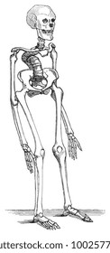 Skeleton of a child with Rachitis bone disease / vintage illustration from Die Frau als hausarztin 1911