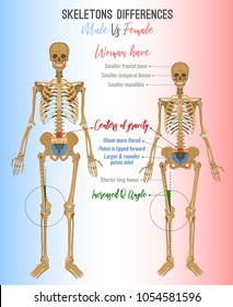 Skeleton differences poster. Male in comparison with female. Major gender nuances. Vector illustration isolated on a light background.