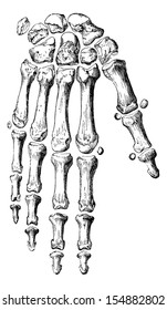 Skeleton of the hand and fingers, vintage engraved illustration. Usual Medicine Dictionary - Paul Labarthe - 1885.