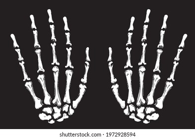 Skeleton of a human hand on a black background