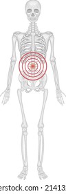 Skeleton lower back suffering from ankylosing spondylitis illustration