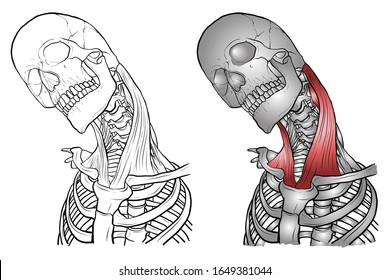 Esqueleto con músculos del cuello En un ángulo de inclinación.