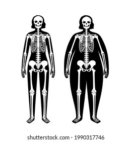 Skeleton system human bones concept. X ray with overweight and normal female silhouette. Skull, arms, legs, knee and foot. Ribs and hand joints. Obese woman body anatomical flat vector illustration.