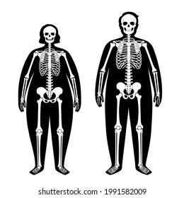 Skeleton system human bones concept. X ray with overweight male and female silhouette. Skull, arms, legs, knee and foot. Ribs and hand joints. Obese man, and woman body anatomical vector illustration.