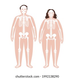Skeleton system human bones concept. X ray with overweight male and female silhouette. Skull, arms, legs, knee and foot. Ribs and hand joints. Obese man, and woman body anatomical vector illustration.