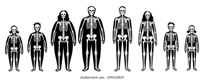 Skeleton system human bones concept. X ray with overweight and normal male and female silhouette. Skull, arms, legs, knee and joints. Obese man, woman, boy and girl body anatomical vector illustration