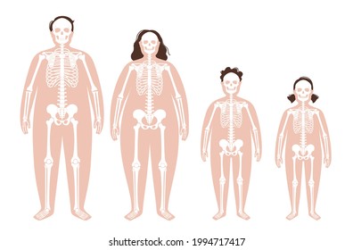 Skeleton system human bones concept. X ray with overweight male and female silhouette. Skull, arms, legs, knee and joints. Obese man, woman, boy and girl body isolated anatomical vector illustration
