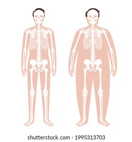 Skeleton system human bones concept. X ray with overweight and normal male silhouette. Skull, arms, legs, knee and foot. Ribs and hand joints. Obese man body anatomical isolated vector illustration.