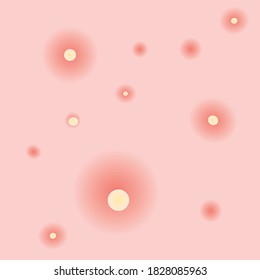 skin with acne, pimple texture- vector illustration