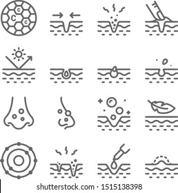 Skin Acne Vector Line Icon Set. It Contains Such Icons As Skin Care, Relax, Dermatology, Sunblock, Treatment, Pimple And More. Expanded Stroke