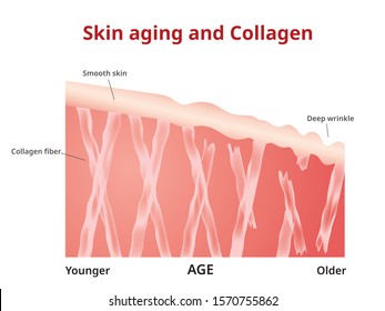 Skin aging, Collagen in young and old skin, Vector