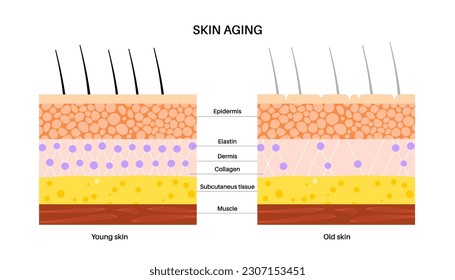 Concepto de envejecimiento cutáneo. Comparación cutánea joven y antigua, componentes de elastano y colágeno. La piel cambia con la edad. Arrugas en el cuerpo con el tiempo. Ilustración vectorial plana de epidermis, dermis e hipodermis.