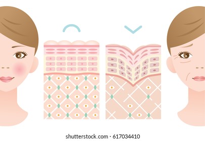 skin aging diagrams. young skin is firm tight, its collagen framework is healthy. old skin sags as it loses its support structure/comparison of young and old skin