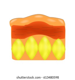 Skin aging in men. Cellulitis. Infographics. Vector illustration on isolated background.