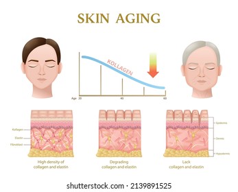 Skin aging process anatomy of layers during decrease of collagen level realistic infographics vector illustration