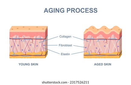 Proceso de envejecimiento cutáneo. Cambios en la estructura de elastina, colágeno y fibroblastos en piel de edad avanzada y joven. Infografía para la cosmetología sobre edad y vitaminas. Dibujo vectorial plano de dibujos animados