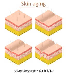 Skin Aging Set Isometric View Normal and Wrinkle Epidermis for Poster and Card. Vector illustration