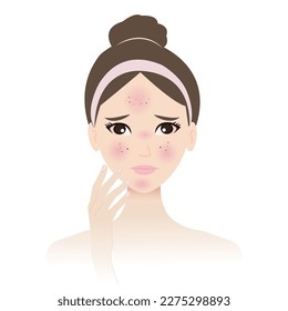 The skin allergy on woman face vector isolated on white background. The allergic reaction skin becomes irritated, rash, itching, burning, redness, bumps, hives, and swelling. Skin problem concept.